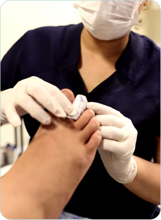 Profissional realizando curativo especializado